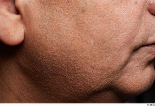 HD Face Skin John Deery cheek chin face skin pores…